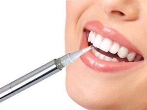 Gel trắng răng là một sản phẩm chứa hợp chất peroxide có khả năng tẩy vết ố vàng, sẫm màu