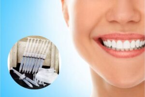 Thuốc tẩy trắng răng là sản phẩm hỗ trợ làm trắng sáng răng