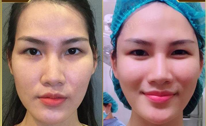Người khác cảm nhận gương mặt gầy gò, già nua, thiếu tự tin