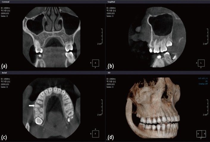 Chụp X-quang Cephalometric và Cone Beam CT