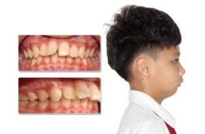 Nguy hiểm lâu dài nếu không điều trị