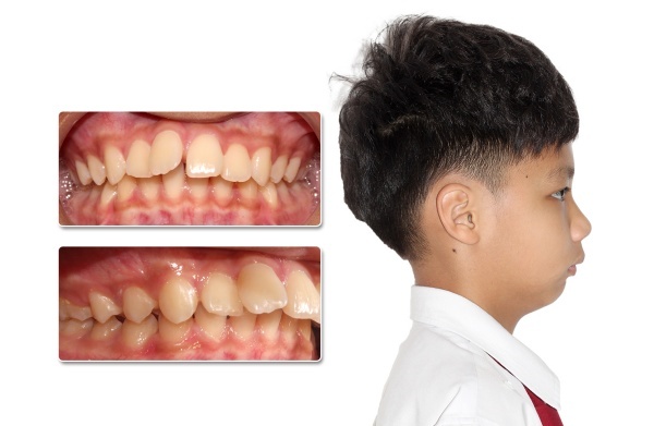Nguy hiểm lâu dài nếu không điều trị