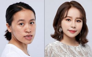 phẫu thuật thẩm mỹ thay đổi hoàn toàn gương mặt