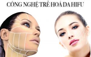 Công nghệ trẻ hóa da Hifu mang đến làn da tươi trẻ