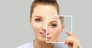 Trẻ hóa da có nhiều phương pháp để bạn áp dụng