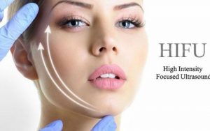 Công nghệ trẻ hóa da Hifu