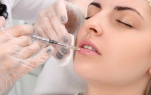 Tiêm filler môi bao nhiêu cc là tốt nhất?