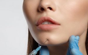 Tìm hiểu về tình trạng tiêm filler cằm xong bị đỏ