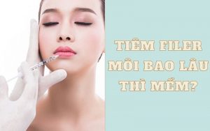 Tiêm filler môi bao lâu thì mềm?