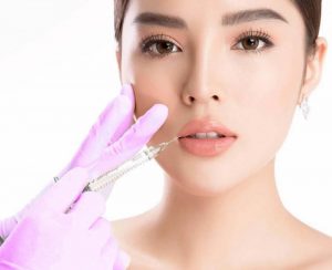 Tiêm tan filler môi giúp xử lý biến chứng liên quan đến chất làm đầy