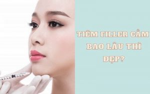 Tiêm filler cằm bao lâu thì đẹp