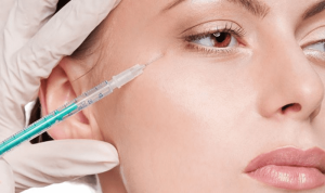 Tiêm filler có tác dụng xóa thâm quầng mắt trong thời gian ngắn