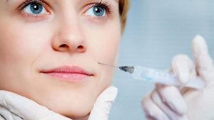 Tiêm filler khóe cười thực hiện nhanh, đơn giản nhưng cho hiệu quả rõ rệt