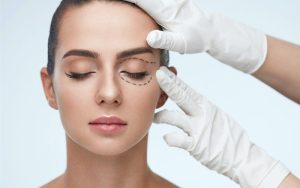 Đo vẽ nếp mí theo tỷ lệ phù hợp với gương mặt trước khi tiến hành phẫu thuật cắt mí