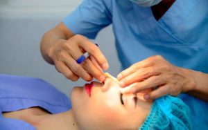 Tùy thuộc vào khuyết điểm của từng khách hàng mà bạn lựa chọn phương pháp khác nhau