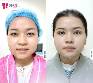 Đôi mắt sâu Tây đầy sức hút làm khuôn mặt thêm quyến rũ