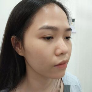 Mũi lõm là tướng mũi xấu tiết lộ cuộc sống cơ cực, vất vả