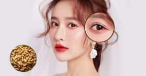 Sau khi cắt mí, bạn có nên ăn đậu phộng không?