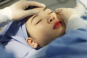 Quy trình thực hiện nhấn mí plasma với 5 bước rõ ràng