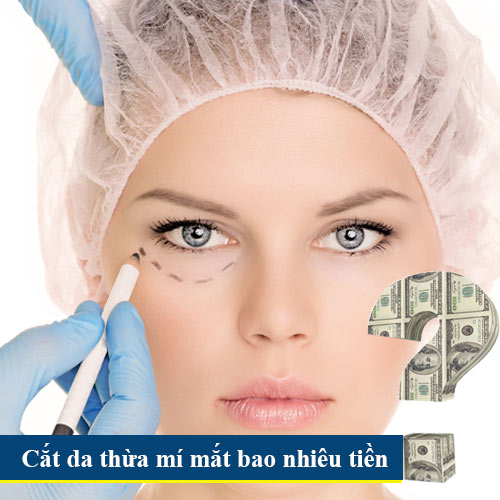 Đội ngũ bác sĩ chuyên khoa áp dụng kỹ thuật cắt da thừa mí mắt hiệu quả