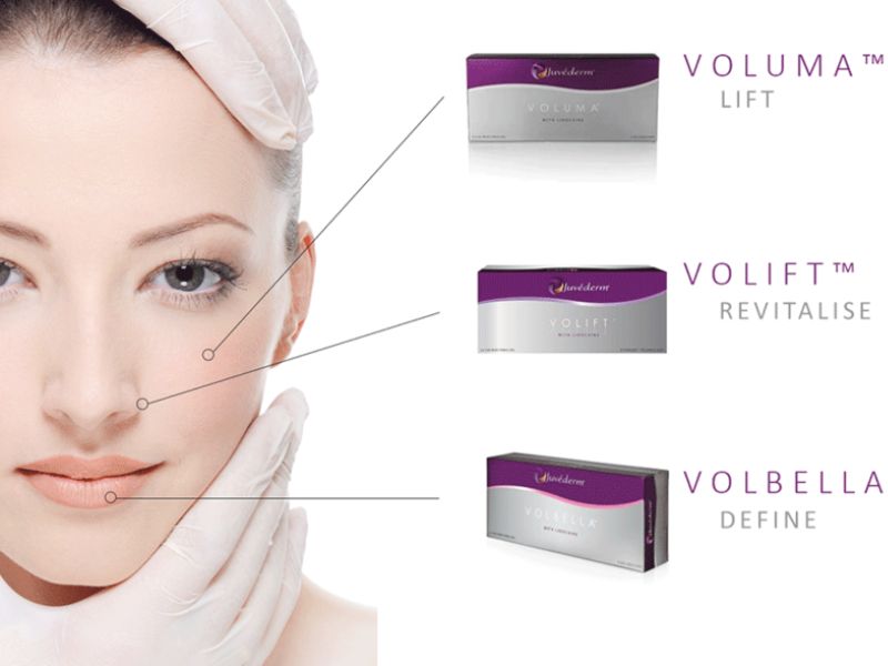 Thời hạn sử dụng của filler tạm thời thường là từ 6 đến 12 tháng