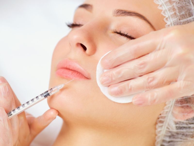Tiêm filler 2 năm không tan có thể do chất làm đầy không chứa thành phần Acid Hyaluronic (HA)