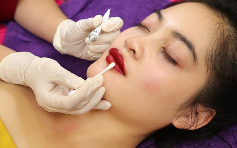 Cách khắc phục môi bị cháy tê