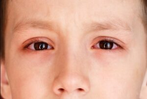 Việc nên cắt lông mi cho bé mấy lần được hầu hết các ông bố bà mẹ quan tâm