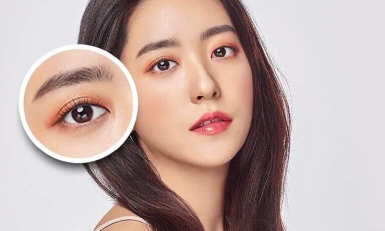 Bấm mí có thể khắc phục mắt trắng dã nhanh chóng và hiệu quả lâu dài
