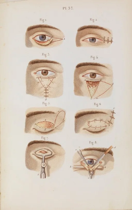 Lời kết