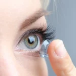 Cắt mí bao lâu thì đeo được kính áp tròng?