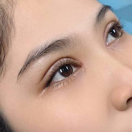 Cắt mí sau bao lâu được uốn mi