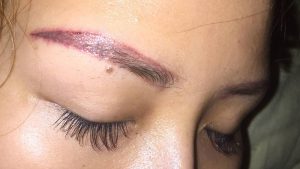 Chân mày sau khi điêu khắc hỏng có thể xóa được