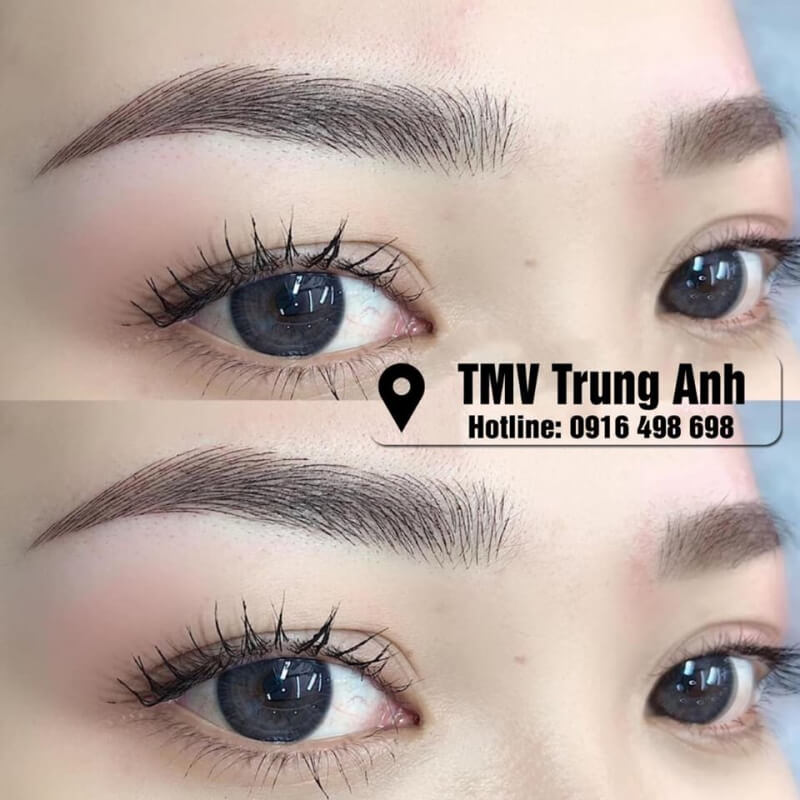 Thẩm Mỹ Viện Công Nghệ Cao Trung Anh ứng dụng công nghệ phun xăm hiện đại