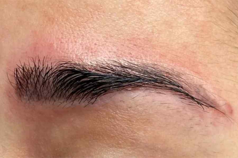 Phần da lông mày dễ bị sưng đỏ, nhiễm trùng sau khi ngâm nước ấm