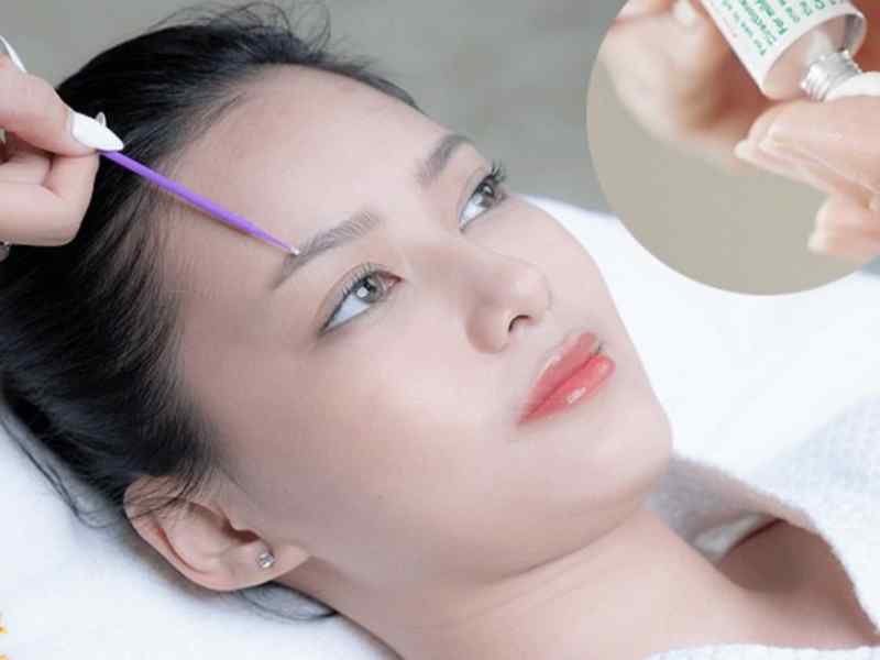 Thuốc mỡ giúp đẩy nhanh quá trình phục hồi sau khi phun xăm
