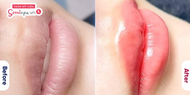 SeoulSpa.vn tự tin mang đến công nghệ phun xăm môi vi chạm an toàn, lên màu chuẩn