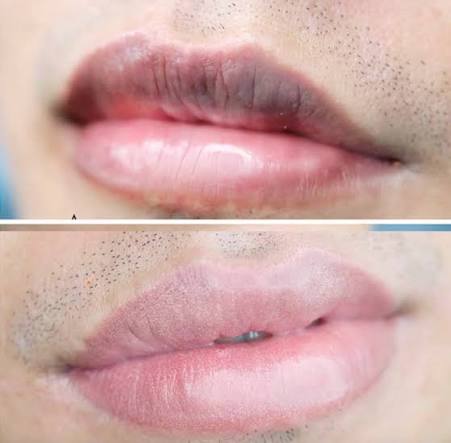 Mỗi phương pháp đều có ưu nhược điểm riêng