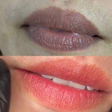 Khử thâm môi giúp loại bỏ các sắc tố gây thâm môi nhưng không lên màu quá đậm
