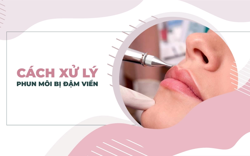 Có nhiều giải pháp xử lý trường hợp phun môi bị đậm viền