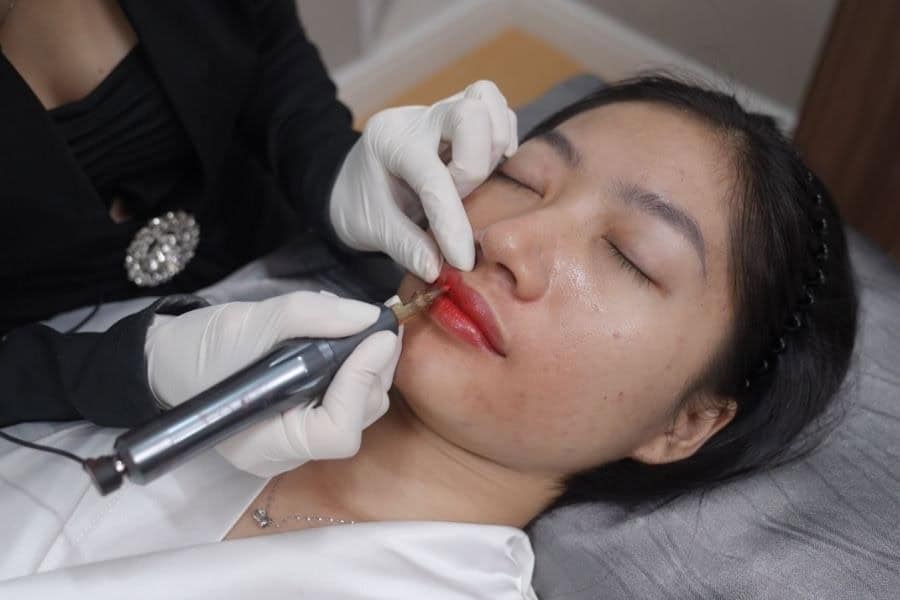 Phun môi miracle được thực hiện theo các bước an toàn chuẩn y khoa