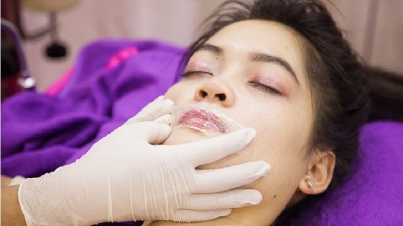 Nên tẩy tế bào chết trước khi thực hiện phun môi không ủ tê