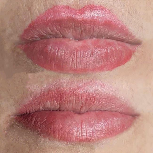 Không nên xử lý tình trạng lem viền môi tại nhà