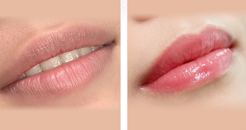 Giải đáp thắc mắc về chi phí khử thâm môi thực tế và các phân khúc giá phổ biến trên thị trường hiện nay