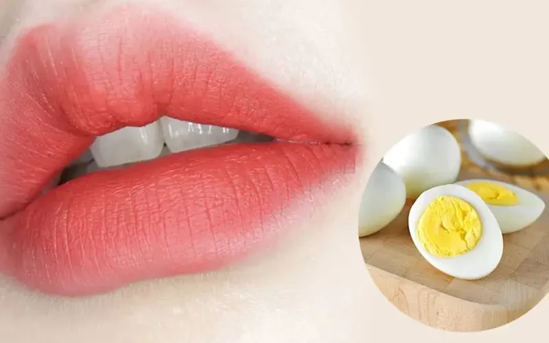 Thành phần đạm trong lòng trắng và sắc tố trong lòng đỏ trứng có thể làm cản trở quá trình bộc lộ màu môi chuẩn