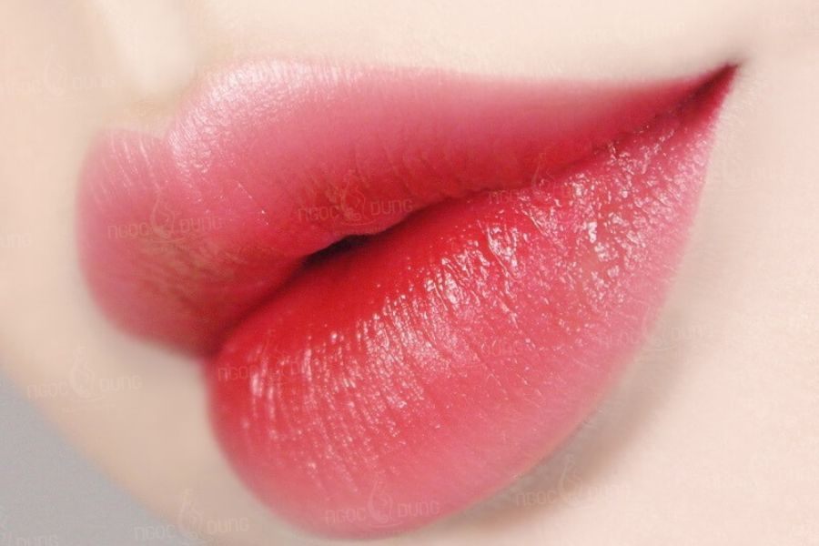 Màu môi đỏ hồng bung nở tươi tắn, bề mặt môi căng mịn tự nhiên và bền bỉ sau khi hồi phục hoàn toàn