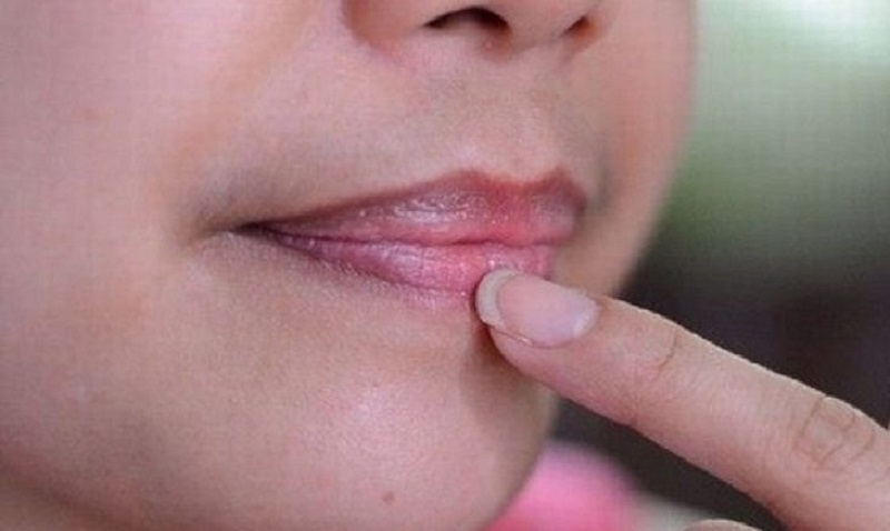 Kết hợp bôi kem dưỡng kích màu chuyên dụng và che chắn chống nắng kỹ càng giúp viền môi mau tươi sáng