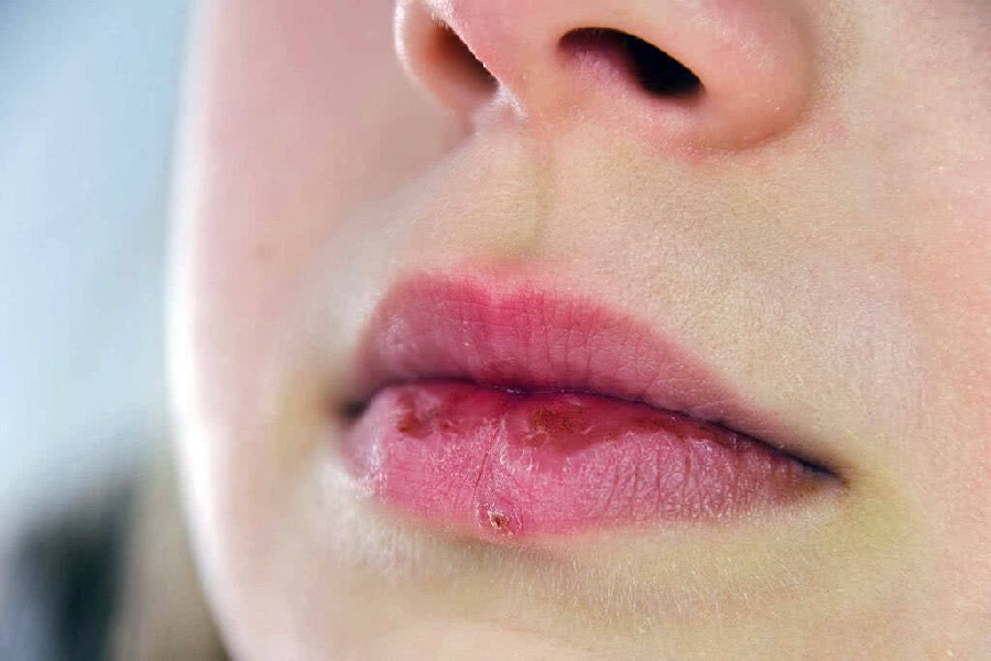Nên ăn các loại thực phẩm giúp hỗ trợ quá trình hồi phục