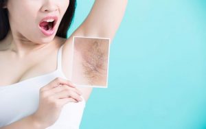 Nên triệt lông nách vĩnh viễn tại nhà bằng cách nào hiệu quả? | S-LIFE
