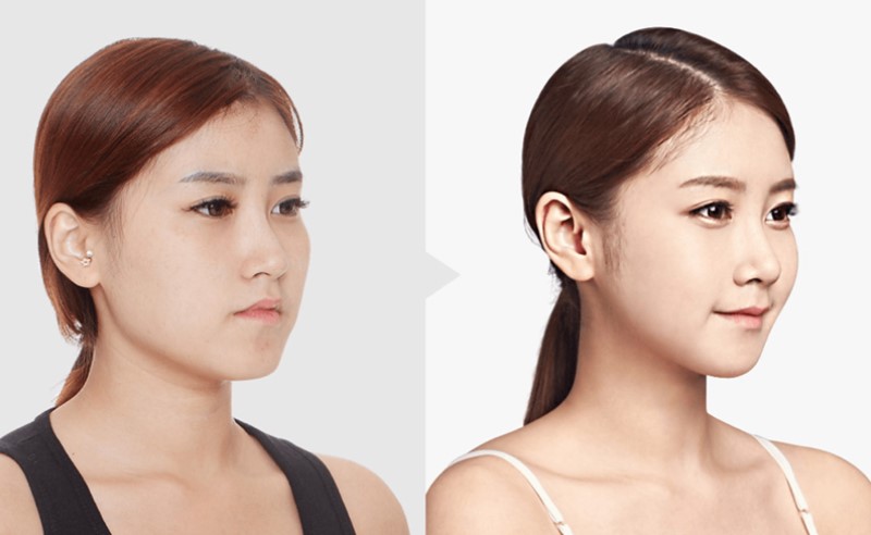 Giảm cân giúp mặt giảm béo hiệu quả